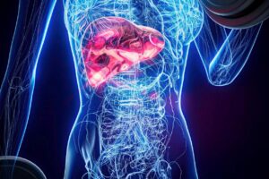 xray woman doing biceps curls